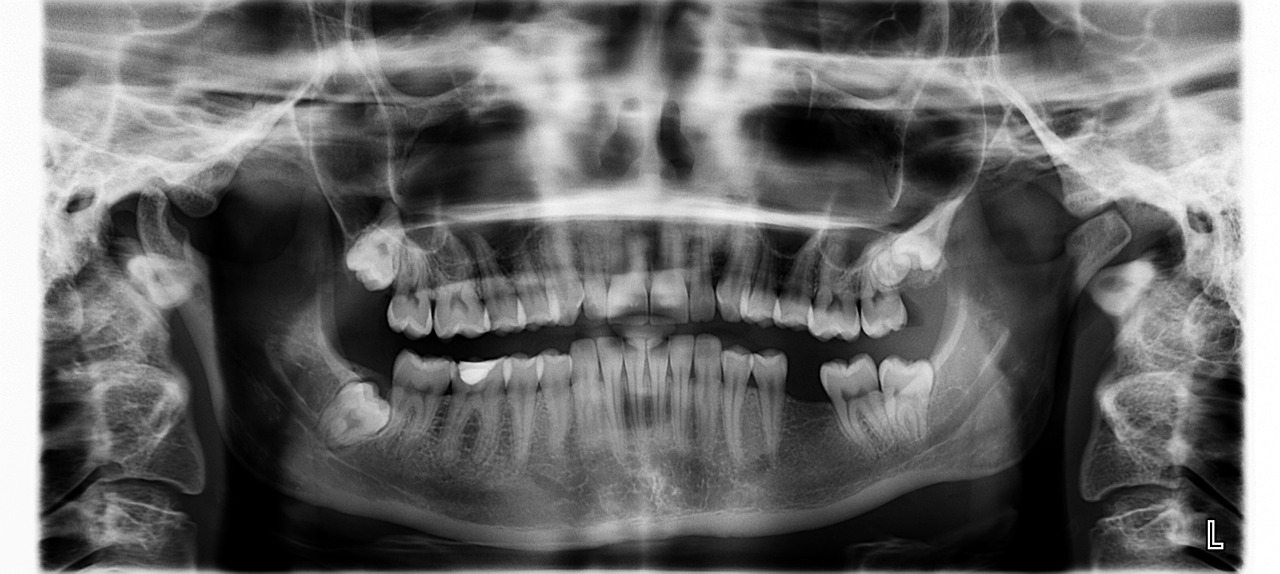 ai powered dental disease detection platform
